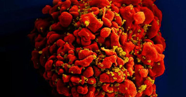 The third case of HIV infection is cured in the world