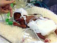 The time between two pregnancies affects infant health