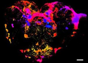 The tiny brain of flies can bring great benefits to humans.