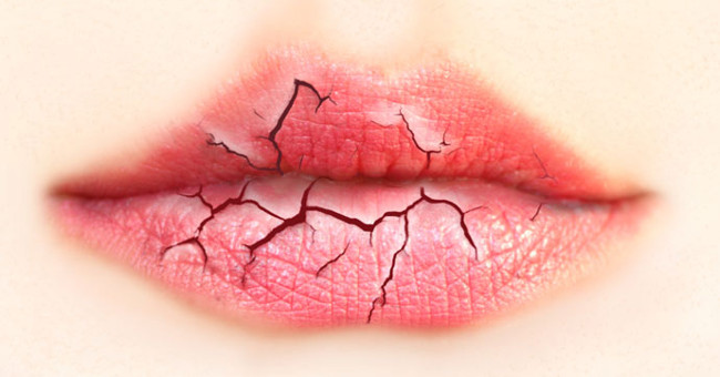 The treatment is common during the cold season, making the mouth always dry