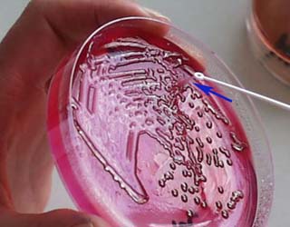 The truth about bacteria causes massive death