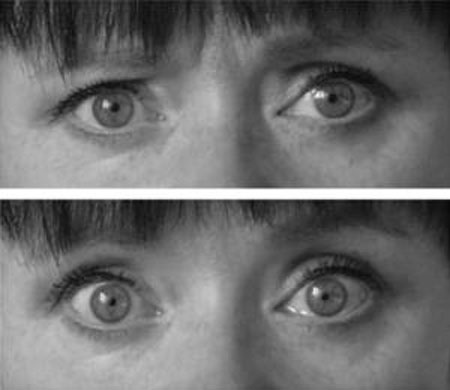 The truth about hypnosis