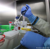 The United States accelerates testing of Ebola vaccine in humans