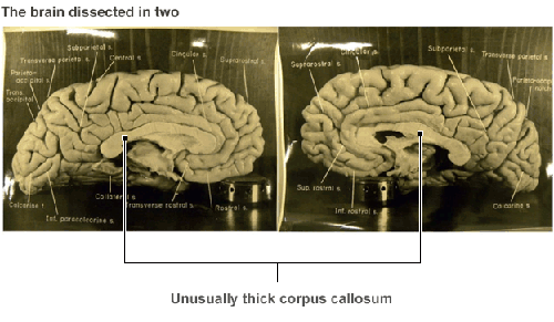 The untold story about Einstein's brain