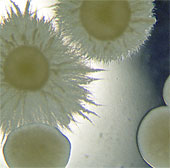 The unusual 'love' type of deadly pathogen