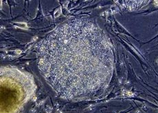 The US House of Representatives passed a bill to support cell research