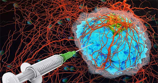 The US successfully tested the type of 'glue' in cancer treatment