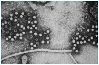 The vaccine against hepatitis E is highly effective