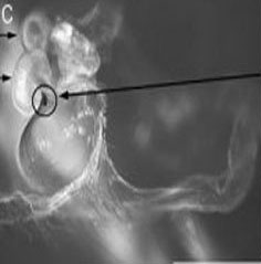 The way to use 'precious' spider's escape is extremely toxic