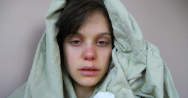 The weather is humid, what disease outbreaks can break out?
