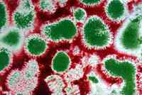 The whole world is worried about outbreaks of bird flu?