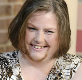 The woman grows a beard like a man