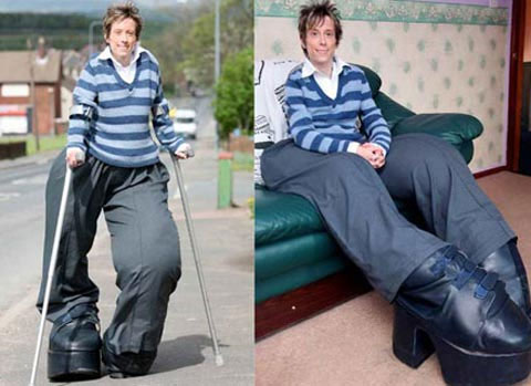 The woman owns elephant legs