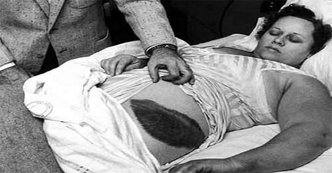 The woman who was hit by a meteorite