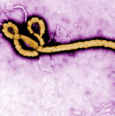 The world is helpless before Ebola translation because ... sex