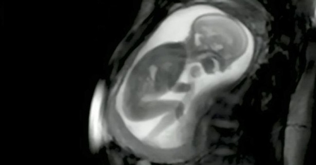 The world's best ultrasound technology helps detect abnormalities in the fetus