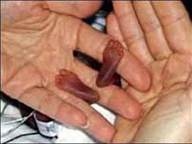 The world's most premature baby is coming home