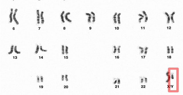 The Y chromosome is slowly degenerating