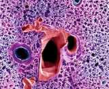 There are cocoons in the lungs