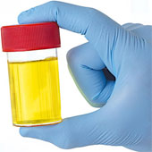 There are more than 3000 substances in urine