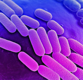 There is an uncontrollable spread of bacteria