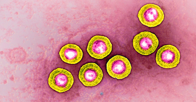 There is going to be a vaccine to prevent herpes virus from causing sexual illness