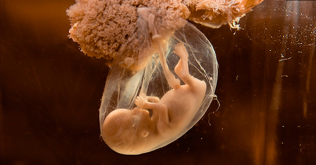 There will be no babies born prematurely thanks to the new remedy