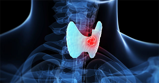 These types of cancer have a hereditary lifetime that you should know