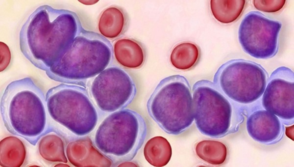 Things to know about blood cancer