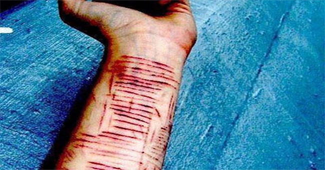 Things you don't know about self-abuse