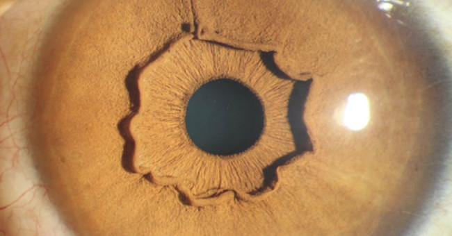 This is the eyes of a person, but why is this weird?