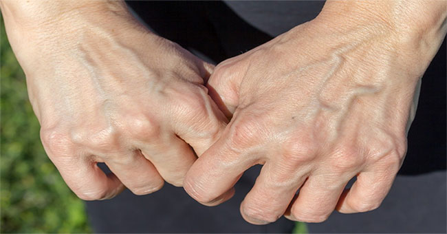 This is the reason why some people have more prominent skin than the rest