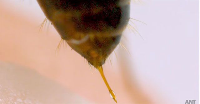 This is what happens when an ant bites you, no wonder it hurts so much