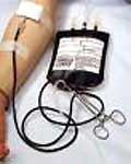 Tiny blood purifier