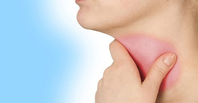 Tips or treatment for sore throats do not take medicine