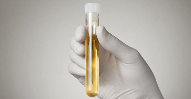 To know your biological age, check your urine sample