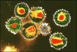Tracked the journey of HIV virus into the center of the cell