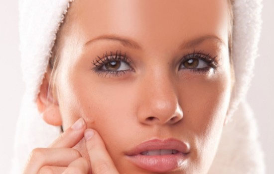 Treat acne with a virus