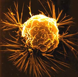 Treat cancer by virus