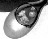 Treat indigestion with dog's gallstones