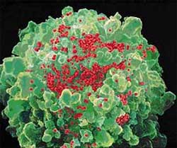 Treat parasitic diseases to help patients fight HIV