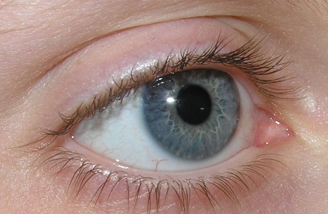 Treat partial blindness with non-invasive stimulation current