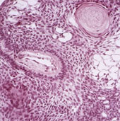 Turn stem cells into cancer machines