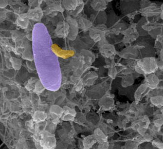 Turn 'vampire' bacteria into living antibiotic