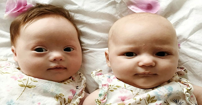 Twins 'million pairs have one'