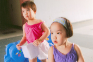 Two separated babies were normal