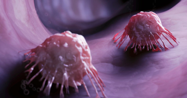 'Ultra-small submarine' carries drugs that kill cancer cells