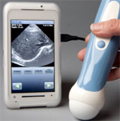 Ultrasonic scanner in smart phones