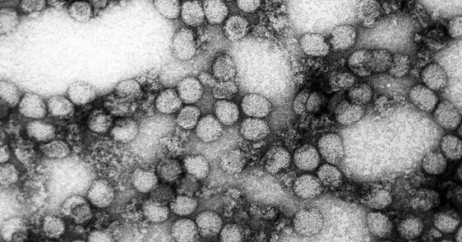 Understanding the Zika virus 'eating human brain' is especially dangerous