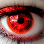 Unexpected 'causes' cause pinkeye